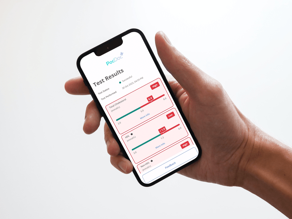 A hand holding a phone showing cholesterol test results in the PocDoc app